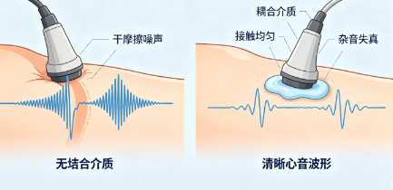 心音传感器采集杂音失真如何优化处理
